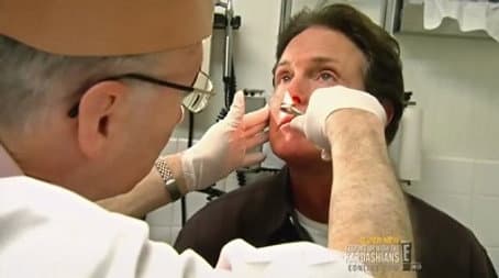 Capitulo 5