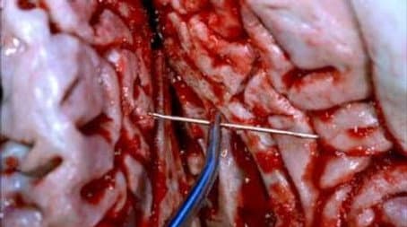 Capitulo 4